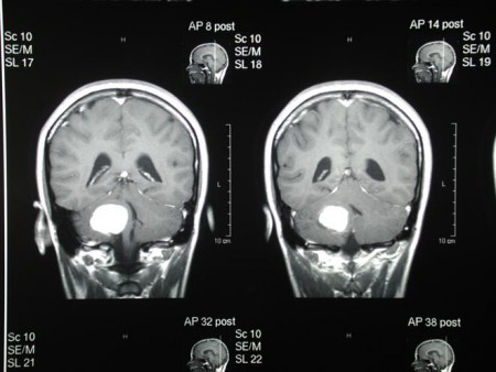 Tomada de: https://www.enter.co/cultura-digital/ciencia/nanoparticulas-de-oro-ayudan-a-remover-tumores-de-manera-precisa/