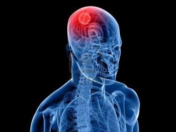 Tomada de: https://noticias.emisorasunidas.com/noticias/salud/una-nueva-tecnica-britanica-ayudara-localizar-tumores-cerebrales-diminutos